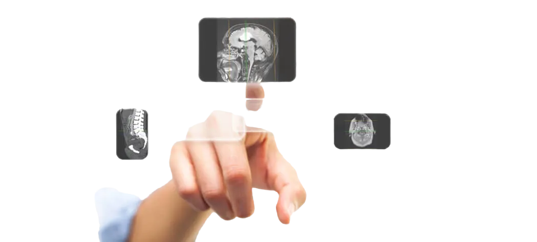 Acceso a información DICOM en la nube