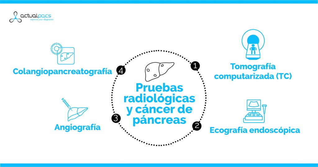 cancer de pancreas