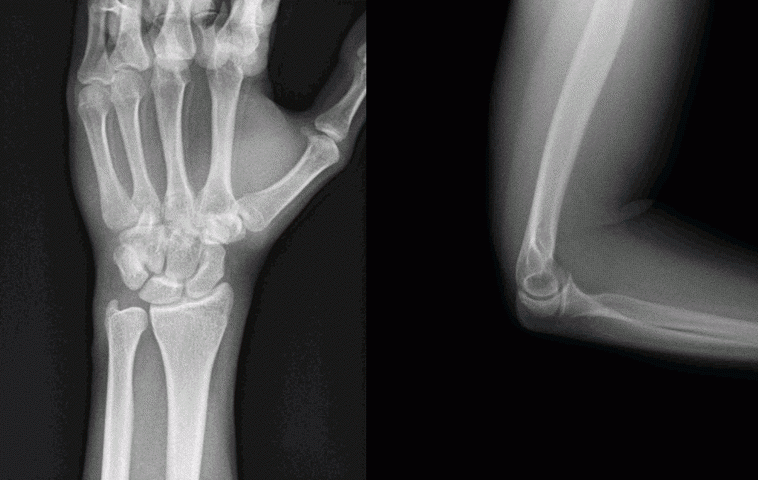 Radiografía digital dinámica: una herramienta de diagnóstico precisa a través de imágenes en movimiento
